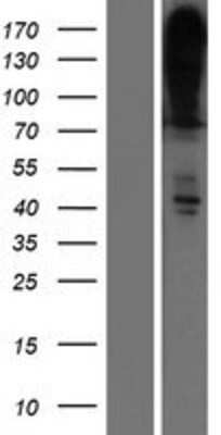 Western Blot: PMCA4 Overexpression Lysate (Adult Normal) [NBP2-10766] Left-Empty vector transfected control cell lysate (HEK293 cell lysate); Right -Over-expression Lysate for PMCA4.