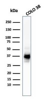Western Blot: PMEL17/SILV Antibody (HMB45 + PMEL/783) - Azide and BSA Free [NBP2-47780] - Western Blot Analysis of COLO-38 cell lysate using PMEL17/SILV MAb (HMB45 + PMEL/783).