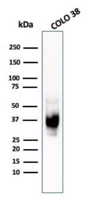 Western Blot: PMEL17/SILV Antibody (HMB45) - Azide and BSA Free [NBP2-34638] - Western Blot Analysis of COLO-38 cell lysate using PMEL17/SILV antibody (HMB45).