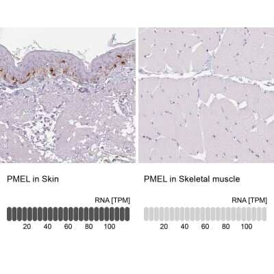 Immunohistochemistry-Paraffin: PMEL17/SILV Antibody [NBP2-38185] - Staining in human skin and skeletal muscle tissues using anti-PMEL antibody. Corresponding PMEL RNA-seq data are presented for the same tissues.