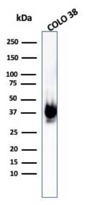 Western Blot: PMEL17/SILV Antibody (PMEL/1825R) - Azide and BSA Free [NBP2-54454] - Western Blot Analysis of COLO-38 cell lysate using PMEL17/SILV Rabbit Recombinant Monoclonal Antibody (PMEL/1825R).