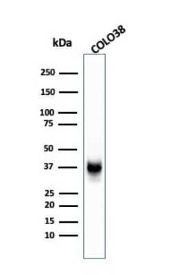 Western Blot: PMEL17/SILV Antibody (SPM142) - Azide and BSA Free [NBP2-34739] - Western Blot Analysis of COLO-38 cell lysate using PMEL17/SILV MAb (SPM142).