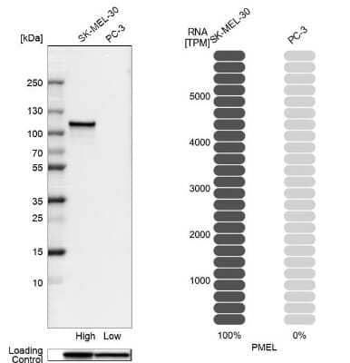 <b>Orthogonal Strategies Validation. </b>Western Blot: PMEL17/SILV Antibody [NBP2-38185] - Analysis in human cell lines SK-MEL-30 and PC-3 using anti-PMEL antibody. Corresponding PMEL RNA-seq data are presented for the same cell lines. Loading control: anti-GAPDH.