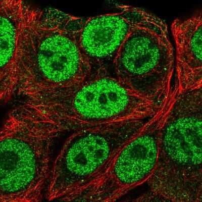Immunocytochemistry/Immunofluorescence: PMF1 Antibody [NBP2-57864] - Staining of human cell line MCF7 shows localization to nucleoplasm & vesicles.