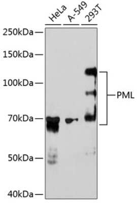 Western Blot: PML Protein Antibody (2A0N10) [NBP3-15835] - Western blot analysis of extracts of various cell lines, using PML Protein antibody (NBP3-15835) at 1:1000 dilution. Secondary antibody: HRP Goat Anti-Rabbit IgG (H+L) at 1:10000 dilution. Lysates/proteins: 25ug per lane. Blocking buffer: 3% nonfat dry milk in TBST. Detection: ECL Enhanced Kit. Exposure time: 3min.