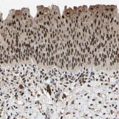 Immunohistochemistry-Paraffin: PML Protein Antibody [NBP1-87783] - Staining of human urinary bladder shows strong nuclear positivity in urothelial cells.