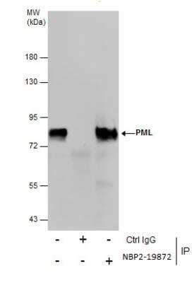 Immunoprecipitation: PML Protein Antibody [NBP2-19872] - Immunoprecipitation of PML protein from A549 whole cell extracts using 5 ug of PML antibody [N1N2], N-term. Western blot analysis was performed using PML antibody [N1N2], N-term. EasyBlot anti-Rabbit IgG was used as a secondary reagent.