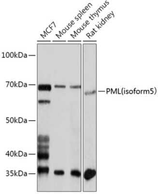 Western Blot: PML Protein Antibody [NBP2-94515] - Analysis of extracts of various cell lines, using PML Protein . Exposure time: 3min.