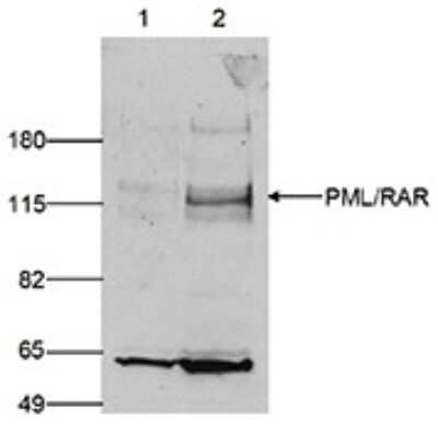 Western Blot: PML Protein Antibody [NBP3-18686] - Figure 2. Western blot analysis using the antibody directed against PML Protein Human embryonic kidney cells (293T) were transfected with an ER-tagged PML Protein/RAR fusion protein. Nuclear extracts (50 ug) from control (lane 1) and from transfected cells (lane 2) were analysed by Western blot using the antibody against PML Protein . The antibody was diluted 1:750 in TBS-Tween containing 5% milk powder. The position of the PML Protein/RAR fusion protein is indicated on the right; the marker (in kDa) is shown on the left. The smaller band of approximately 60 kDa might represent the endogenous PML Protein protein.