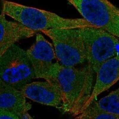 Immunocytochemistry/Immunofluorescence: PMM1/Phosphomannomutase 1 Antibody [NBP3-17530] - Staining of human cell line SK-MEL-30 shows localization to cytosol.