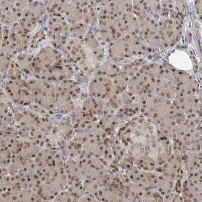 Immunohistochemistry-Paraffin: PMM1/Phosphomannomutase 1 Antibody [NBP1-87055] - Staining of human pancreas shows moderate nuclear positivity in exocrine glandular cells.