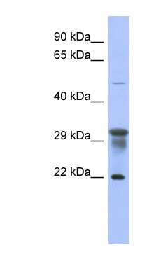 Western Blot: PMM1/Phosphomannomutase 1 Antibody [NBP1-55475] - 293T cells lysate, concentration 0.2-1 ug/ml.