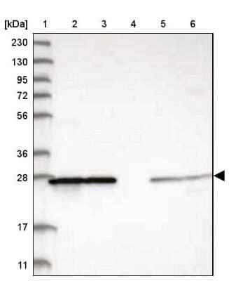 Western Blot PMM1/Phosphomannomutase 1 Antibody