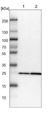 Western Blot: PMM1/Phosphomannomutase 1 Antibody [NBP1-87055] - Lane 1: NIH-3T3 cell lysate (Mouse embryonic fibroblast cells). Lane 2: NBT-II cell lysate (Rat Wistar bladder tumor cells).