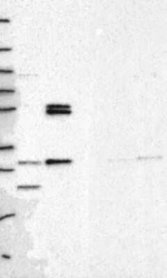 Western Blot: PMM1/Phosphomannomutase 1 Antibody [NBP3-17530] - Lane 1: Marker [kDa] 250, 130, 95, 72, 55, 36, 28, 17, 10;   Lane 2: RT4;   Lane 3: U-251 MG;   Lane 4: Human Plasma;   Lane 5: Liver;   Lane 6: Tonsil