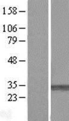 Western Blot: PMM1/Phosphomannomutase 1 Overexpression Lysate (Adult Normal) [NBL1-14536] Left-Empty vector transfected control cell lysate (HEK293 cell lysate); Right -Over-expression Lysate for PMM1/Phosphomannomutase 1.