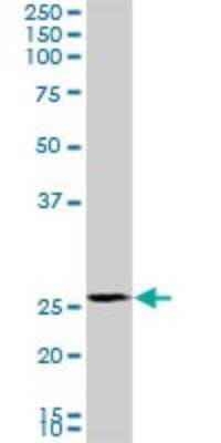 Western Blot: PMM2/Phosphomannomutase 2 Antibody (2A5) [H00005373-M02] - PMM2 monoclonal antibody (M02), clone 2A5. Analysis of PMM2 expression in K-562.