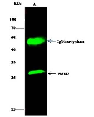 Immunoprecipitation: PMM2/Phosphomannomutase 2 Antibody [NBP3-00351] - PMM2/Phosphomannomutase 2 was immunoprecipitated using: Lane A: 0.5 mg MCF-7 Whole Cell Lysate. 2 ul anti-PMM2/Phosphomannomutase 2 rabbit polyclonal antibody and 15 ul of 50 % Protein G agarose. Primary antibody: Anti-PMM2/Phosphomannomutase 2 rabbit polyclonal antibody, at 1:200 dilution. Secondary antibody: Dylight 800-labeled antibody to rabbit IgG (H+L), at 1:5000 dilution. Developed using the Odyssey technique. Performed under reducing conditions. Predicted band size: 27 kDa. Observed band size: 27 kDa