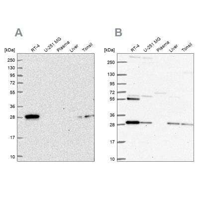 <b>Independent Antibodies Validation. </b>PMM2/Phosphomannomutase 2 Antibody [NBP1-85716] - Analysis using Anti-PMM2 antibody NBP1-85716 (A) shows similar pattern to independent antibody NBP2-57753 (B).