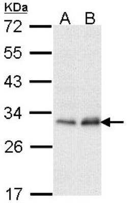 Western Blot: PMM2/Phosphomannomutase 2 Antibody [NBP1-33750] - Sample (30 ug of whole cell lysate)  A: Hela  B: Hep G2  12% SDS PAGE  diluted at 1:1000 