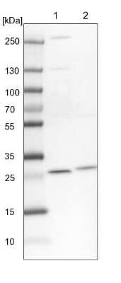 Western Blot: PMM2/Phosphomannomutase 2 Antibody [NBP1-85716] - Lane 1: NIH-3T3 cell lysate (Mouse embryonic fibroblast cells) Lane 2: NBT-II cell lysate (Rat Wistar bladder tumour cells)