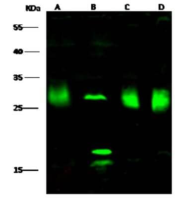 Western Blot: PMM2/Phosphomannomutase 2 Antibody [NBP3-00351] - Anti-PMM2/Phosphomannomutase 2 rabbit polyclonal antibody at 1:500 dilution. Lane A: Hela Whole Cell Lysate. Lane B: K562 Whole Cell Lysate. Lane C: MCF7 Whole Cell Lysate. Lane D: HepG2 Whole Cell Lysate. Lysates/proteins at 30 ug per lane. Secondary Goat Anti-Rabbit IgG H&L (Dylight 800) at 1/10000 dilution. Developed using the Odyssey technique. Performed under reducing conditions. Predicted band size: 28 kDa. Observed band size: 28 kDa (We are unsure as to the identity of these extra bands).