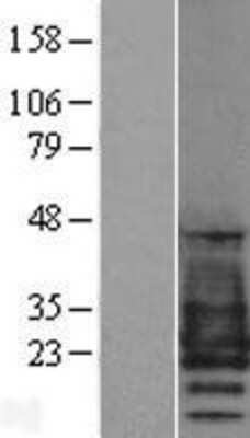 Western Blot: PMP22 Overexpression Lysate (Adult Normal) [NBP2-09039] Left-Empty vector transfected control cell lysate (HEK293 cell lysate); Right -Over-expression Lysate for PMP22.
