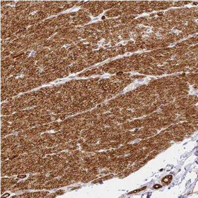 Immunohistochemistry-Paraffin SLC25A17 Antibody