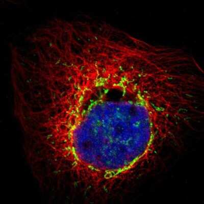 Immunocytochemistry/Immunofluorescence: PMPCA Antibody [NBP1-89126] - Immunofluorescent staining of human cell line A-431 shows localization to mitochondria. Antibody staining is shown in green.