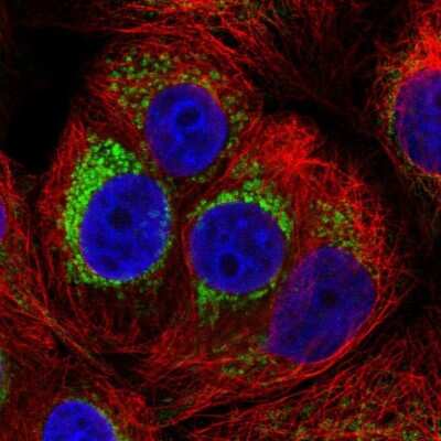 <b>Independent Antibodies Validation. </b>Immunocytochemistry/Immunofluorescence: PMPCA Antibody [NBP2-57169] - Staining of human cell line MCF7 shows localization to mitochondria. Antibody staining is shown in green.