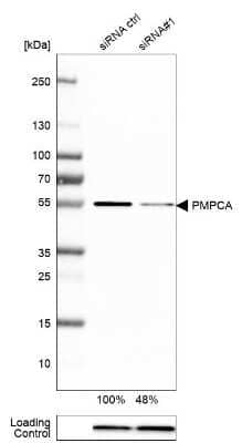 Western Blot: PMPCA Antibody [NBP1-89126] - Analysis in HEK293 cells transfected with control siRNA, target specific siRNA probe #1, using Anti-PMPCA antibody. Remaining relative intensity is presented. Loading control: Anti-PPIB.