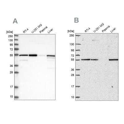 <b>Independent Antibodies Validation. </b>Western Blot: PMPCA Antibody [NBP1-89126] - Analysis using Anti-PMPCA antibody NBP1-89126 (A) shows similar pattern to independent antibody NBP2-57169 (B).