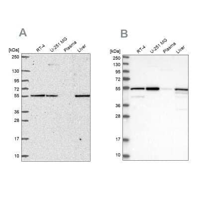 Western Blot: PMPCA Antibody [NBP2-57169] - Analysis using Anti-PMPCA antibody NBP2-57169 (A) shows similar pattern to independent antibody NBP1-89126 (B).