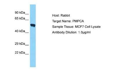 Western Blot: PMPCA Antibody [NBP2-85505] - Host: Rabbit. Target Name: PMPCA. Sample Type: MCF7 Whole Cell lysates. Antibody Dilution: 1.0ug/mlPMPCA is supported by BioGPS gene expression data to be expressed in MCF7