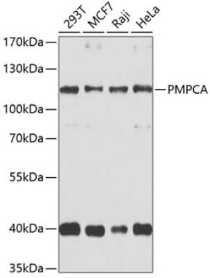 Western Blot: PMPCA Antibody [NBP2-94327] - Analysis of extracts of various cell lines, using PMPCA at 1:1000 dilution. Secondary antibody: HRP Goat Anti-Rabbit IgG (H+L) at 1:10000 dilution. Lysates/proteins: 25ug per lane. Blocking buffer: 3% nonfat dry milk in TBST. Detection: ECL Basic Kit . Exposure time: 30s.