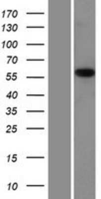 Western Blot: PMPCA Overexpression Lysate (Adult Normal) [NBP2-07206] Left-Empty vector transfected control cell lysate (HEK293 cell lysate); Right -Over-expression Lysate for PMPCA.