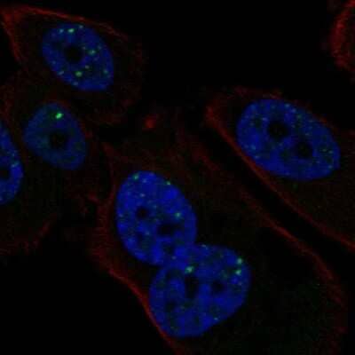 Immunocytochemistry/Immunofluorescence: PMS1 Antibody [NBP2-58368] - Staining of human cell line PC-3 shows localization to nuclear bodies.