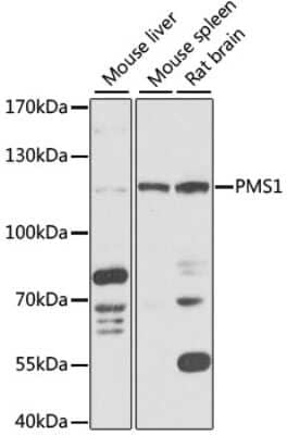 Western Blot: PMS1 Antibody [NBP2-94782] - Analysis of extracts of various cell lines, using PMS1 at 1:1000 dilution. Secondary antibody: HRP Goat Anti-Rabbit IgG (H+L) at 1:10000 dilution. Lysates/proteins: 25ug per lane. Blocking buffer: 3% nonfat dry milk in TBST. Detection: ECL Basic Kit . Exposure time: 5s.