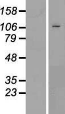 Western Blot: PMS1 Overexpression Lysate (Adult Normal) [NBP2-09011] Left-Empty vector transfected control cell lysate (HEK293 cell lysate); Right -Over-expression Lysate for PMS1.