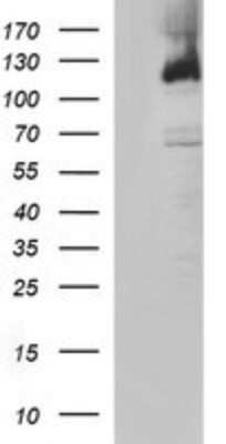 Western Blot: PMS2 Antibody (OTI2G5) - Azide and BSA Free [NBP2-73481] - Analysis of HEK293T cells were transfected with the pCMV6-ENTRY control (Left lane) or pCMV6-ENTRY PMS2.