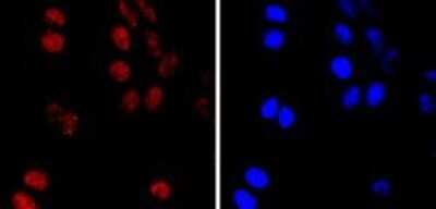 Immunocytochemistry/Immunofluorescence: PMS2 Antibody (SY08-09) [NBP2-67069] - Staining PMS2 in Hela cells (red). The nuclear counter stain is DAPI (blue). Cells were fixed in paraformaldehyde, permeabilised with 0.25% Triton X100/PBS.