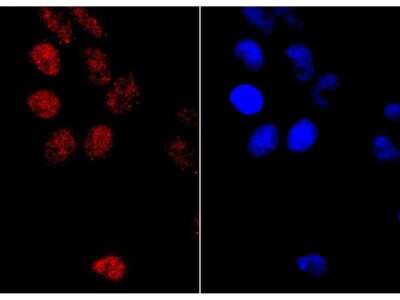 Immunocytochemistry/Immunofluorescence: PMS2 Antibody (SY08-09) [NBP2-67069] - Staining PMS2 in Hela cells (red). Formalin fixed cells were permeabilized with 0.1% Triton X-100 in TBS for 10 minutes at room temperature and blocked with 1% Blocker BSA for 15 minutes at room temperature. Cells were probed with the primary antibody (1/100) for 1 hour at room temperature, washed with PBS. Alexa Fluor(R)488 Goat anti-Rabbit IgG was used as the secondary antibody at 1/1,000 dilution. The nuclear counter stain is DAPI (blue).