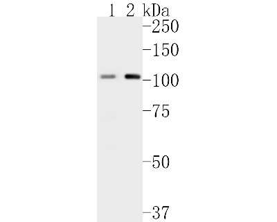 Western Blot: PMS2 Antibody (SY08-09) [NBP2-67069] - Western blot analysis of PMS2 on different lysates. Proteins were transferred to a PVDF membrane and blocked with 5% BSA in PBS for 1 hour at room temperature. The primary antibody (1/500) was used in 5% BSA at room temperature for 2 hours. Goat Anti-Rabb