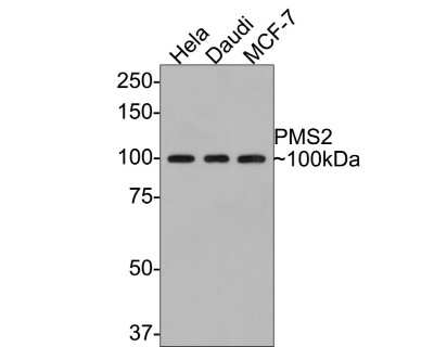 Western Blot: PMS2 Antibody (SY08-09) [NBP2-67069] - Analysis of PMS2 on different lysates with Rabbit anti-PMS2 antibody at 1/500 dilution. Lane 1: Hela cell lysate. Lane 2: Daudi cell lysate. Lane 3: MCF-7 cell lysate. Lysates/proteins at 10 ug/Lane. Predicted band size: 96 kDa. Observed band size: 100 kDa. Exposure time: 2 minutes; 8% SDS-PAGE gel. Proteins were transferred to a PVDF membrane and blocked with 5% NFDM/TBST for 1 hour at room temperature. The primary antibody at 1/500 dilution was used in 5% NFDM/TBST at room temperature for 2 hours. Goat Anti-Rabbit IgG - HRP Secondary Antibody at 1:200,000 dilution was used for 1 hour at room temperature.