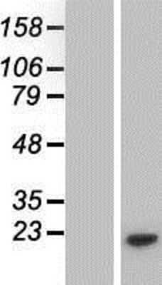 Western Blot PMS5 Overexpression Lysate