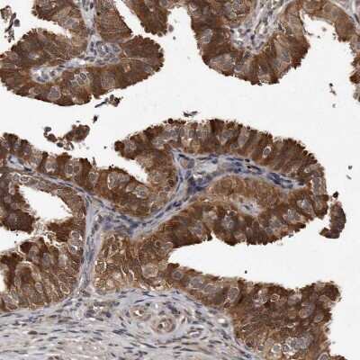 Immunohistochemistry PMVK/phosphomevalonate kinase Antibody