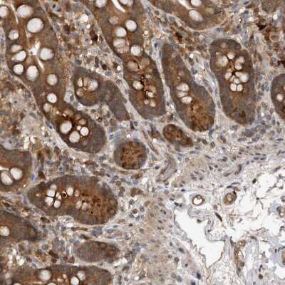 Immunohistochemistry-Paraffin PMVK/phosphomevalonate kinase Antibody