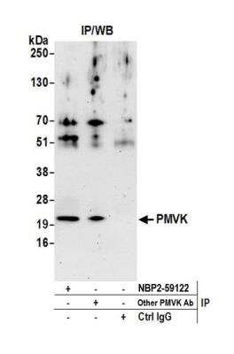 Immunoprecipitation: PMVK/phosphomevalonate kinase Antibody [NBP2-59122] - Detection of human PMVK by western blot of immunoprecipitates. Samples: Whole cell lysate (0.5 or 1.0 mg per IP reaction; 20% of IP loaded) from 293T cells prepared using NETN lysis buffer. Antibodies: Affinity purified rabbit anti-PMVK antibody NBP2-59122 used for IP at 8 ul per reaction. PMVK was also immunoprecipitated by another rabbit anti-PMVK antibody. For blotting immunoprecipitated PMVK, NBP2-59122 was used at 1:1000. Detection: Chemiluminescence with an exposure time of 3 seconds.
