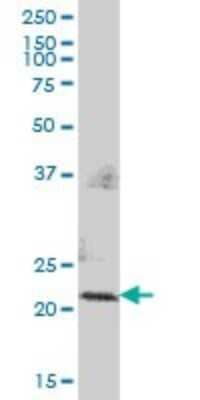 Western Blot: PMVK/phosphomevalonate kinase Antibody [H00010654-B01P] - Analysis of PMVK expression in human kidney.