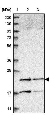 Western Blot PMVK/phosphomevalonate kinase Antibody